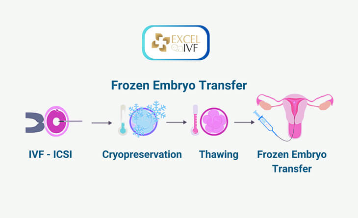 Frozen embryo transfer