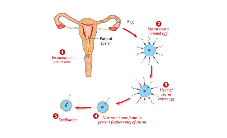 Causes of Infertility in Women