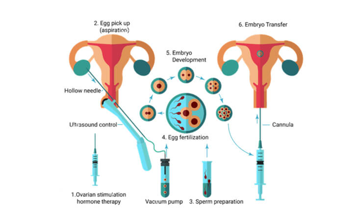 Fertility treatment