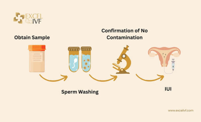 Why IUI Fails - Common Reasons and Solutions