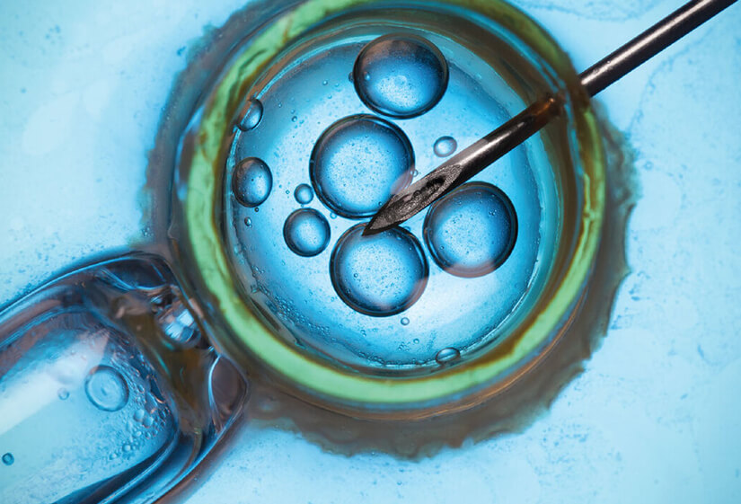 IVF Treatment in Delhi