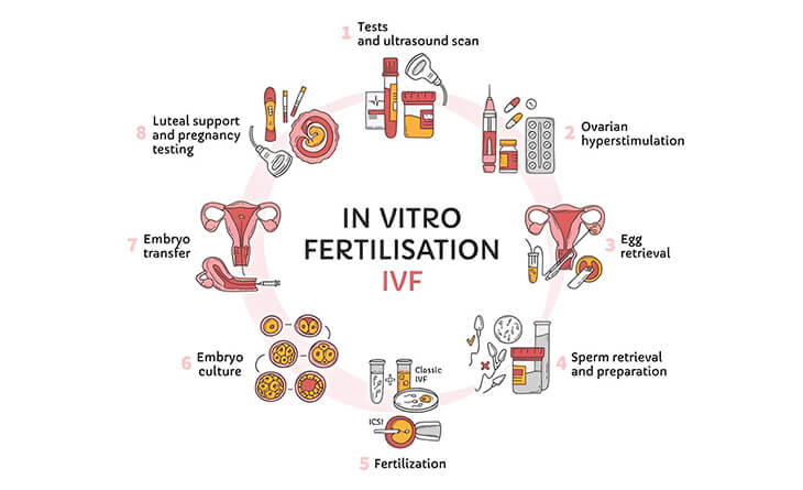 IVF Treatment in Delhi