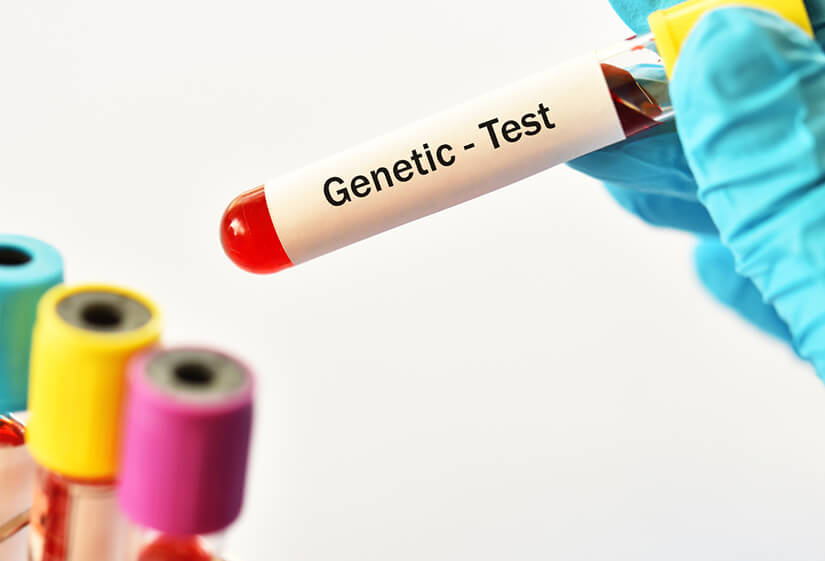 Genetic Testing