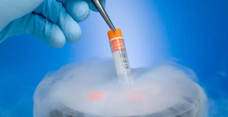 Ovarian Tissue Cryopreservation