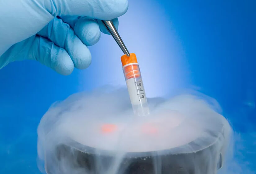 Ovarian Tissue Cryopreservation