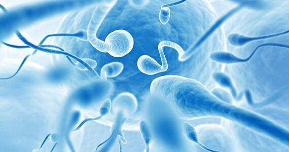 Male Fertility Tests in Delhi - Dr Rhythm Gupta - Excel IVF -01 Male Fertility Tests in Delhi - Dr Rhythm Gupta - Excel IVF -01