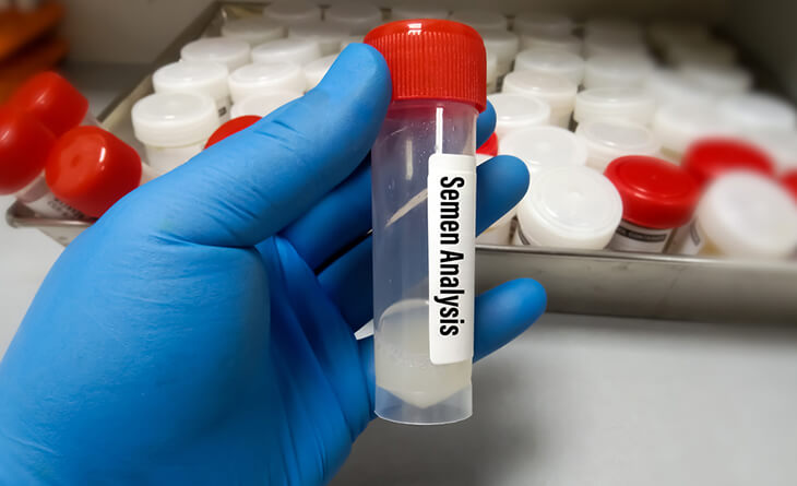 Low sperm count treatment