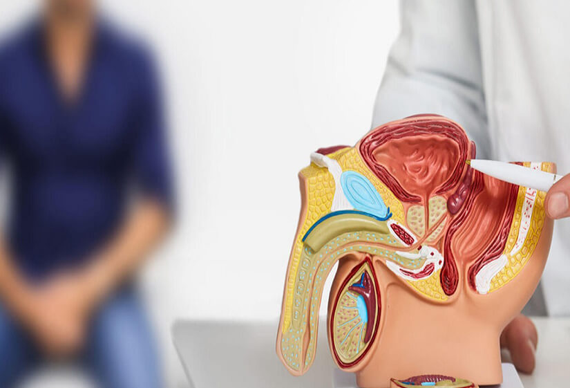 Duration of male infertility treatment
